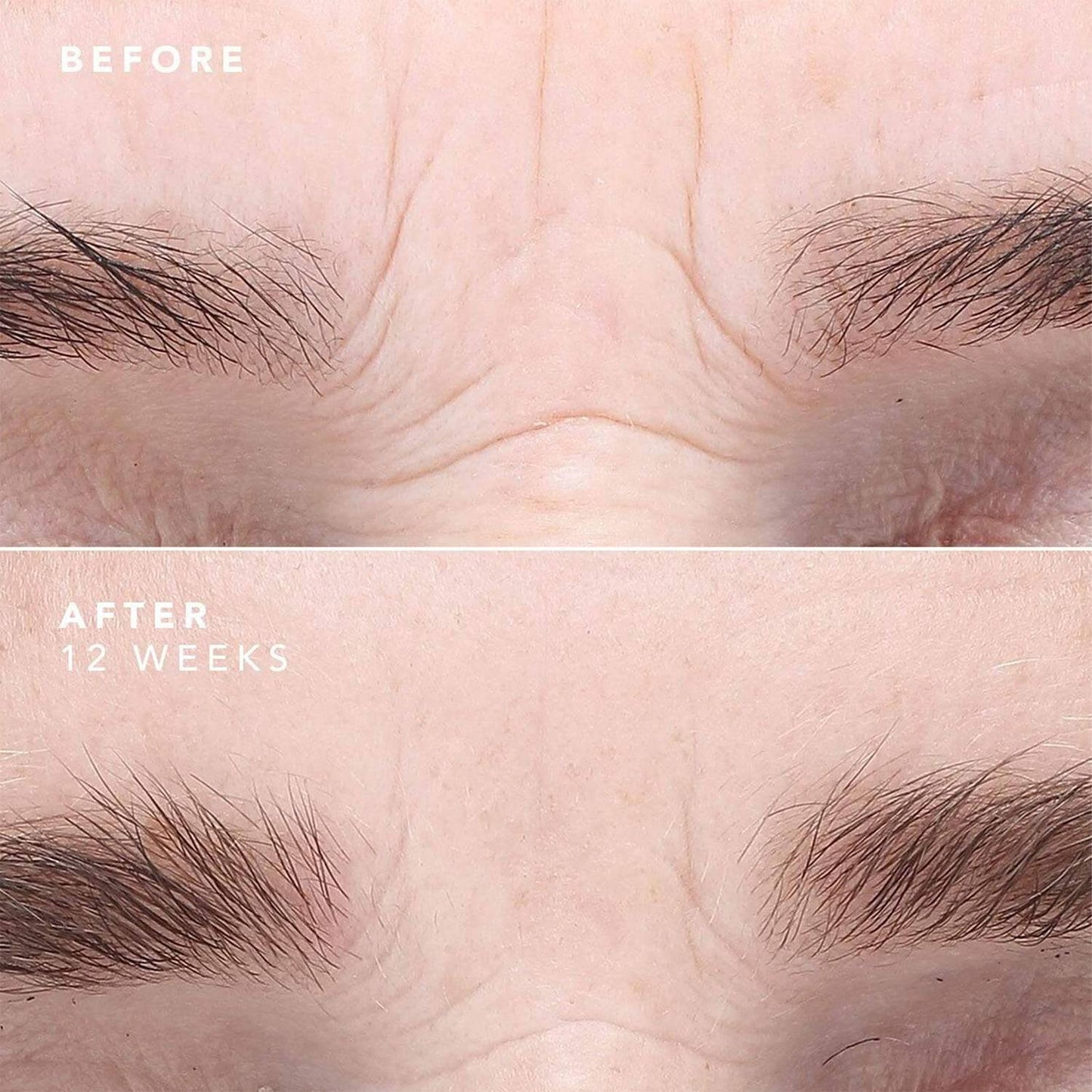 Антивікова сироватка для обличчя Bioeffect EGF Serum