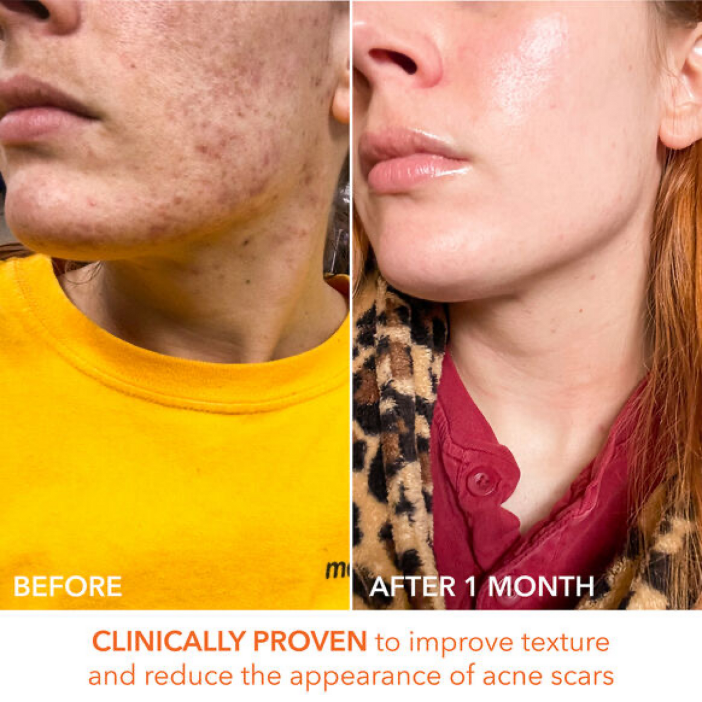 Пілинг Dr. Dennis Gross Alpha Beta Universal Daily Peel